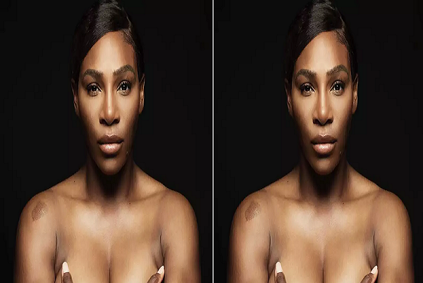 Serena Williams goes topless, promotes Breast Cancer Awareness pic