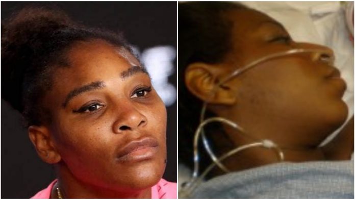 Prayers Up, Serena William Hospitalized In Critical