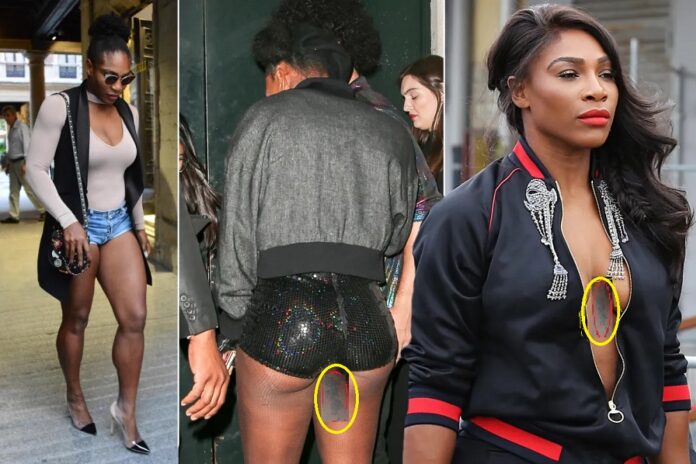Serena Williams loves to show some of her skin